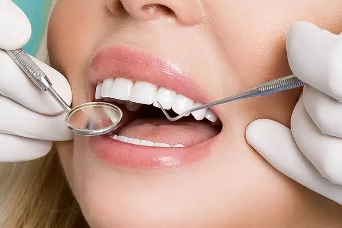 Dental bonding at Union Family Dental