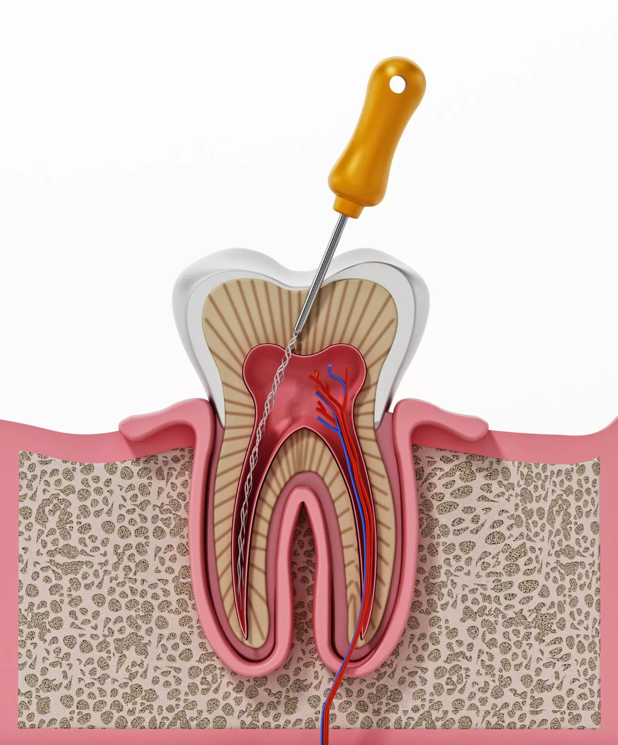 Root canal therapy at Union Family Dental