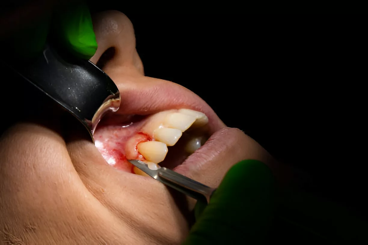 Surgical and periodontal dentistry at Union Family Dental